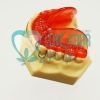 Cosa è l'ortodonzia intercettiva?