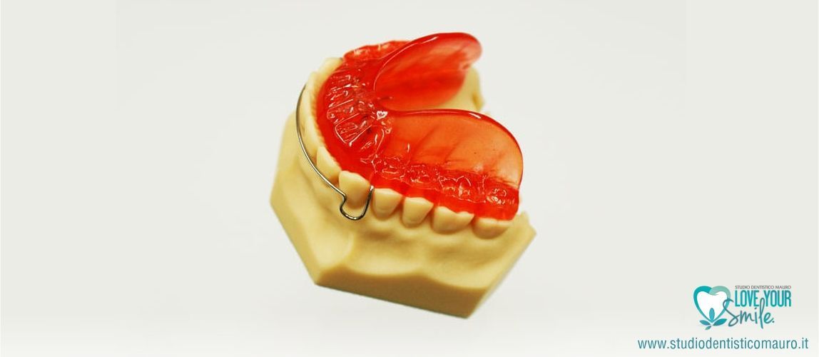 Cosa è l'ortodonzia intercettiva?