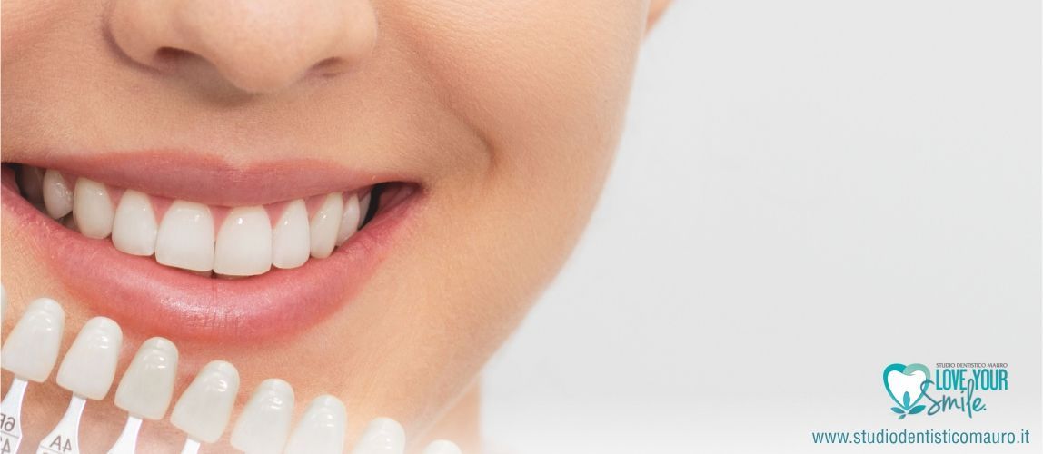 Sbiancamento dentale: tutto quello che non vi hanno mai detto!
